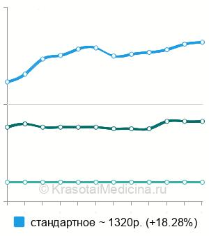 Средняя стоимость УЗИ лимфатических узлов в Самаре